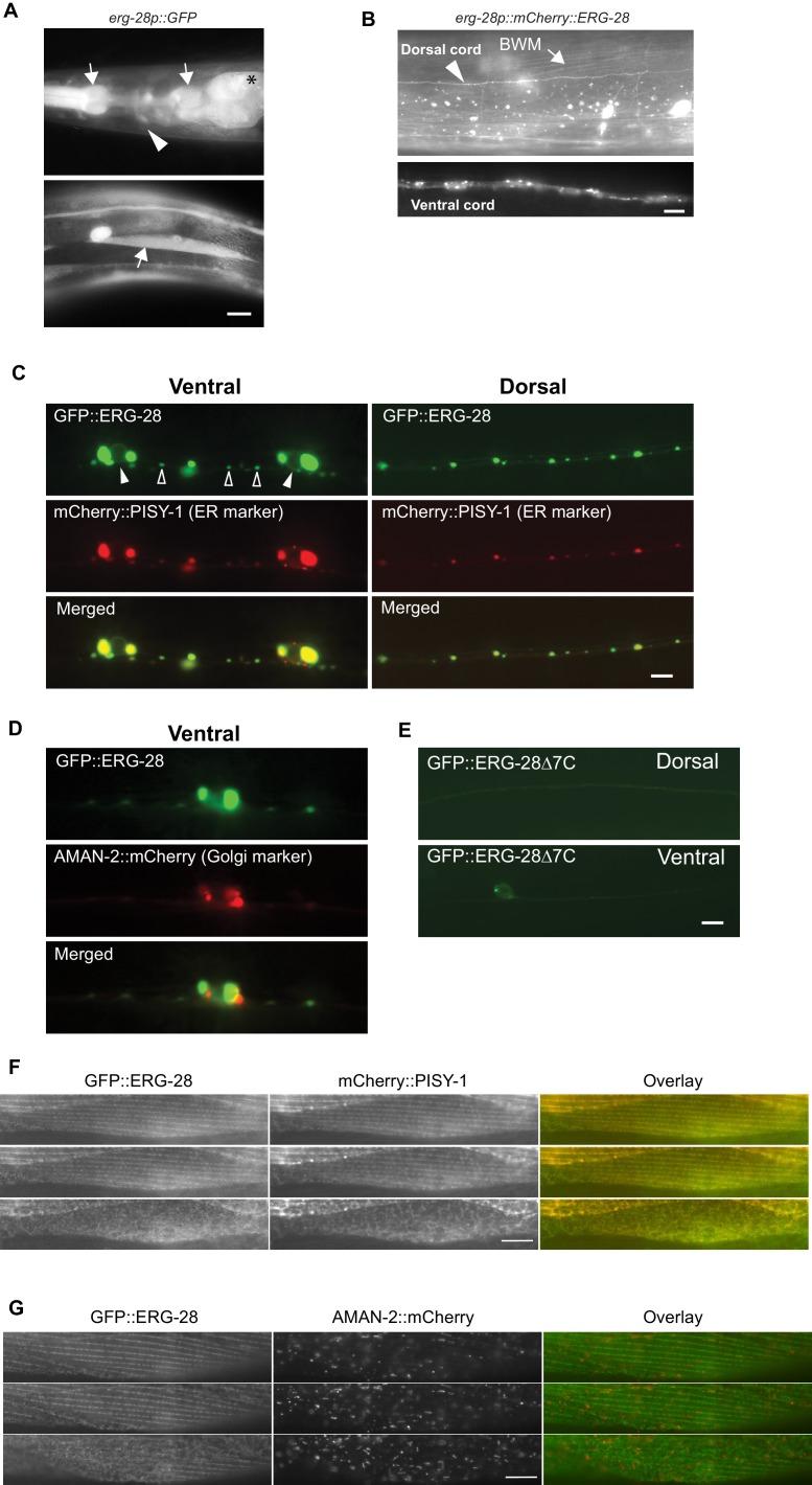 https://cdn.ncbi.nlm.nih.gov/pmc/blobs/025f/5295816/1056b0100474/elife-24733-fig3.jpg