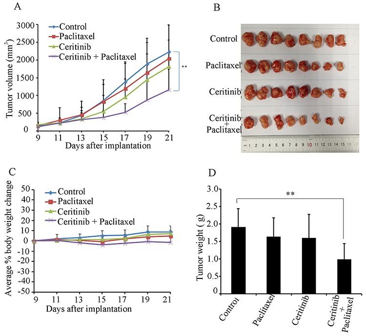 https://cdn.ncbi.nlm.nih.gov/pmc/blobs/02e5/4792582/9f476476dd98/oncotarget-06-44643-g002.jpg