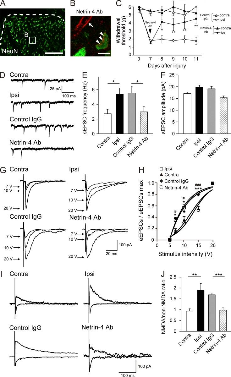 https://cdn.ncbi.nlm.nih.gov/pmc/blobs/0404/5154943/d6aaa222ce81/JEM_20160877_Fig6.jpg