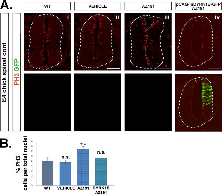 https://cdn.ncbi.nlm.nih.gov/pmc/blobs/041e/11072594/ff97e547e456/18_2023_5097_Fig6_HTML.jpg