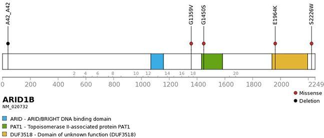 https://cdn.ncbi.nlm.nih.gov/pmc/blobs/056d/5542239/eeb092515ae4/oncotarget-08-45943-g002.jpg