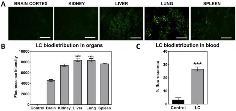 https://cdn.ncbi.nlm.nih.gov/pmc/blobs/0645/12114706/902fd3a152e9/pharmaceutics-17-00656-g002.jpg