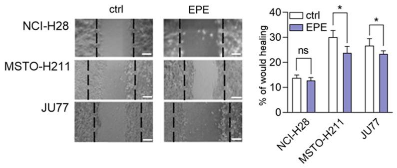 https://cdn.ncbi.nlm.nih.gov/pmc/blobs/06c7/7699585/ba0eacdc7615/biomolecules-10-01574-g005.jpg