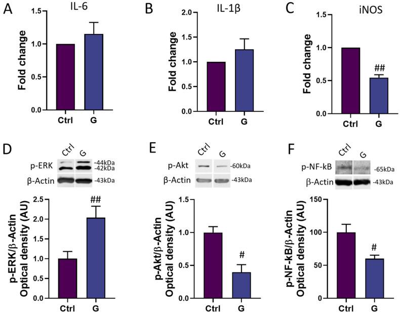 https://cdn.ncbi.nlm.nih.gov/pmc/blobs/08a1/10886616/eeee5d5fa87f/cells-13-00355-g005.jpg
