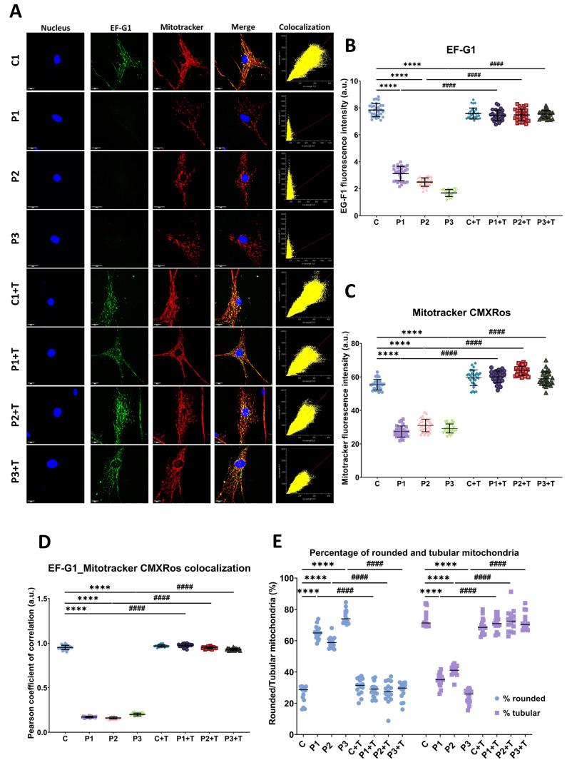 https://cdn.ncbi.nlm.nih.gov/pmc/blobs/0dc9/11118892/5f40b8544ae9/biomolecules-14-00598-g004.jpg