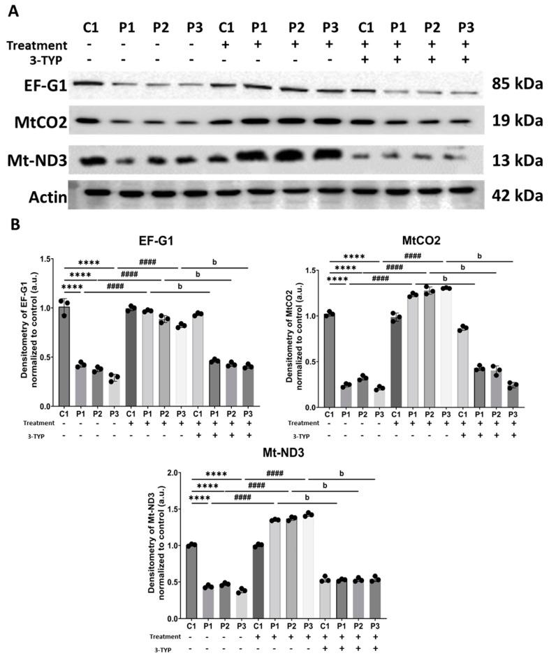 https://cdn.ncbi.nlm.nih.gov/pmc/blobs/0dc9/11118892/66c1b8e6e333/biomolecules-14-00598-g014.jpg
