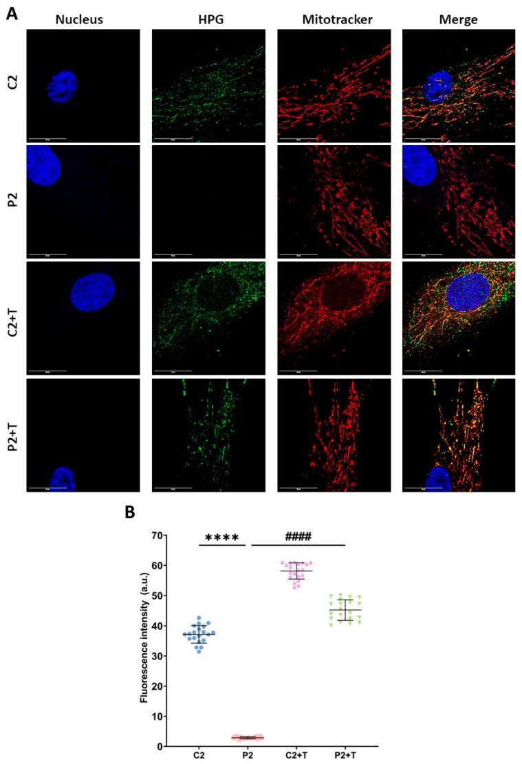 https://cdn.ncbi.nlm.nih.gov/pmc/blobs/0dc9/11118892/6b0e66f01ec8/biomolecules-14-00598-g005.jpg