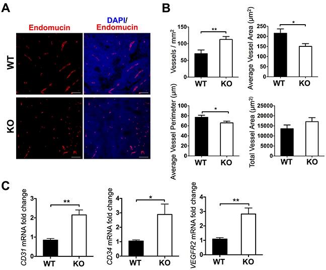 https://cdn.ncbi.nlm.nih.gov/pmc/blobs/0dce/5085172/c5a8c9e57982/oncotarget-07-34507-g002.jpg