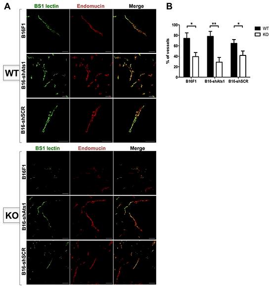 https://cdn.ncbi.nlm.nih.gov/pmc/blobs/0dce/5085172/c8ce2a2dfca5/oncotarget-07-34507-g005.jpg