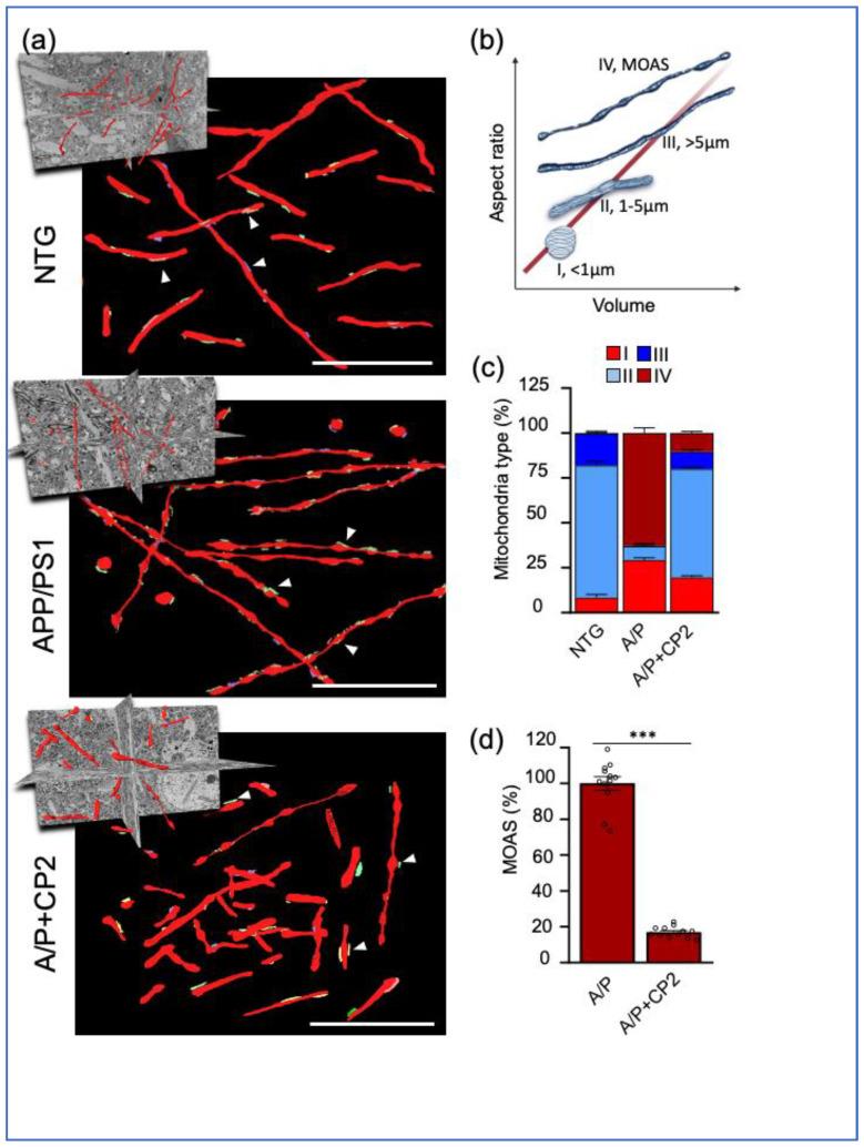 https://cdn.ncbi.nlm.nih.gov/pmc/blobs/107a/10137328/9067d429b789/cells-12-01111-g003.jpg
