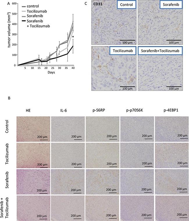 https://cdn.ncbi.nlm.nih.gov/pmc/blobs/17ab/5589655/3569436ff886/oncotarget-08-55230-g006.jpg