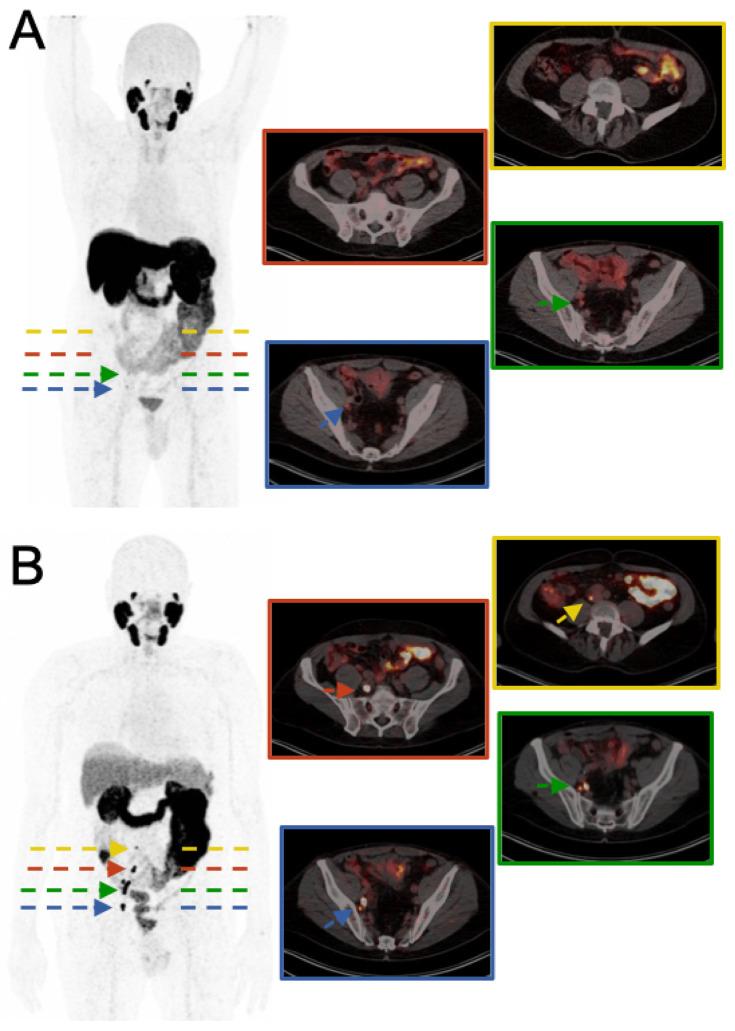 https://cdn.ncbi.nlm.nih.gov/pmc/blobs/1949/11506669/4670bf6e65b4/diagnostics-14-02321-g001.jpg