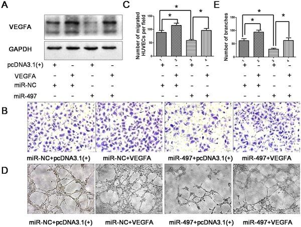 https://cdn.ncbi.nlm.nih.gov/pmc/blobs/1985/4745744/b3b25308fc87/oncotarget-06-29527-g005.jpg