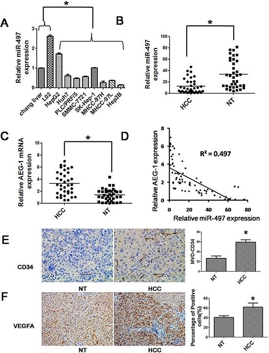 https://cdn.ncbi.nlm.nih.gov/pmc/blobs/1985/4745744/cd82073dae8a/oncotarget-06-29527-g001.jpg
