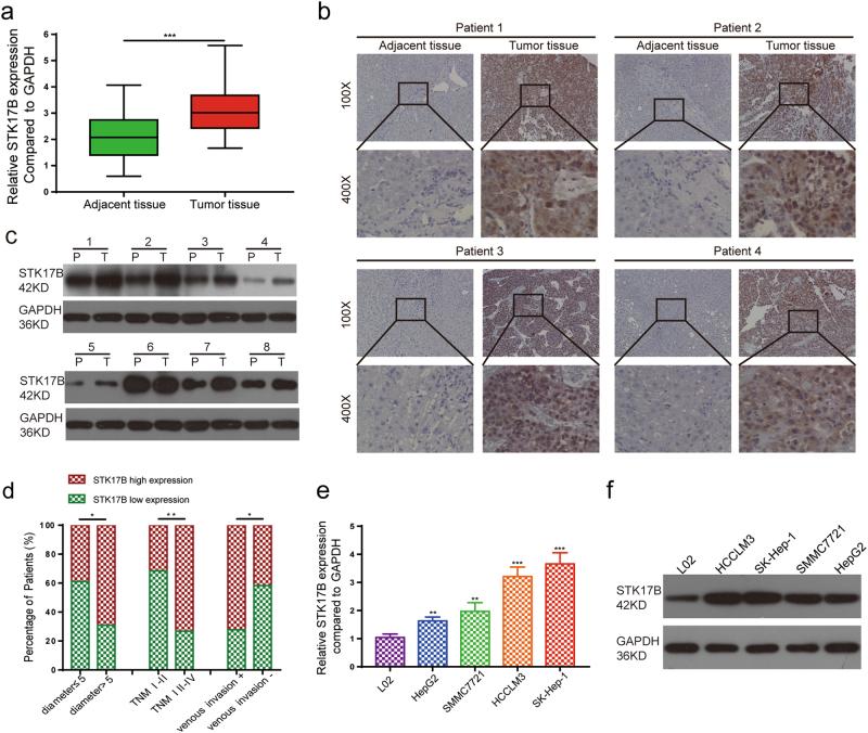 https://cdn.ncbi.nlm.nih.gov/pmc/blobs/1dcd/5833726/0bbb8ce75c95/41419_2018_262_Fig1_HTML.jpg
