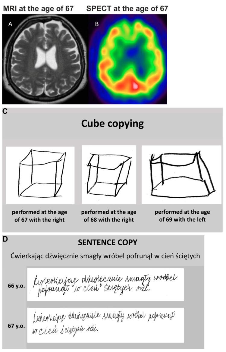 https://cdn.ncbi.nlm.nih.gov/pmc/blobs/1dcf/9778325/70e5a7d15448/genes-13-02361-g001.jpg