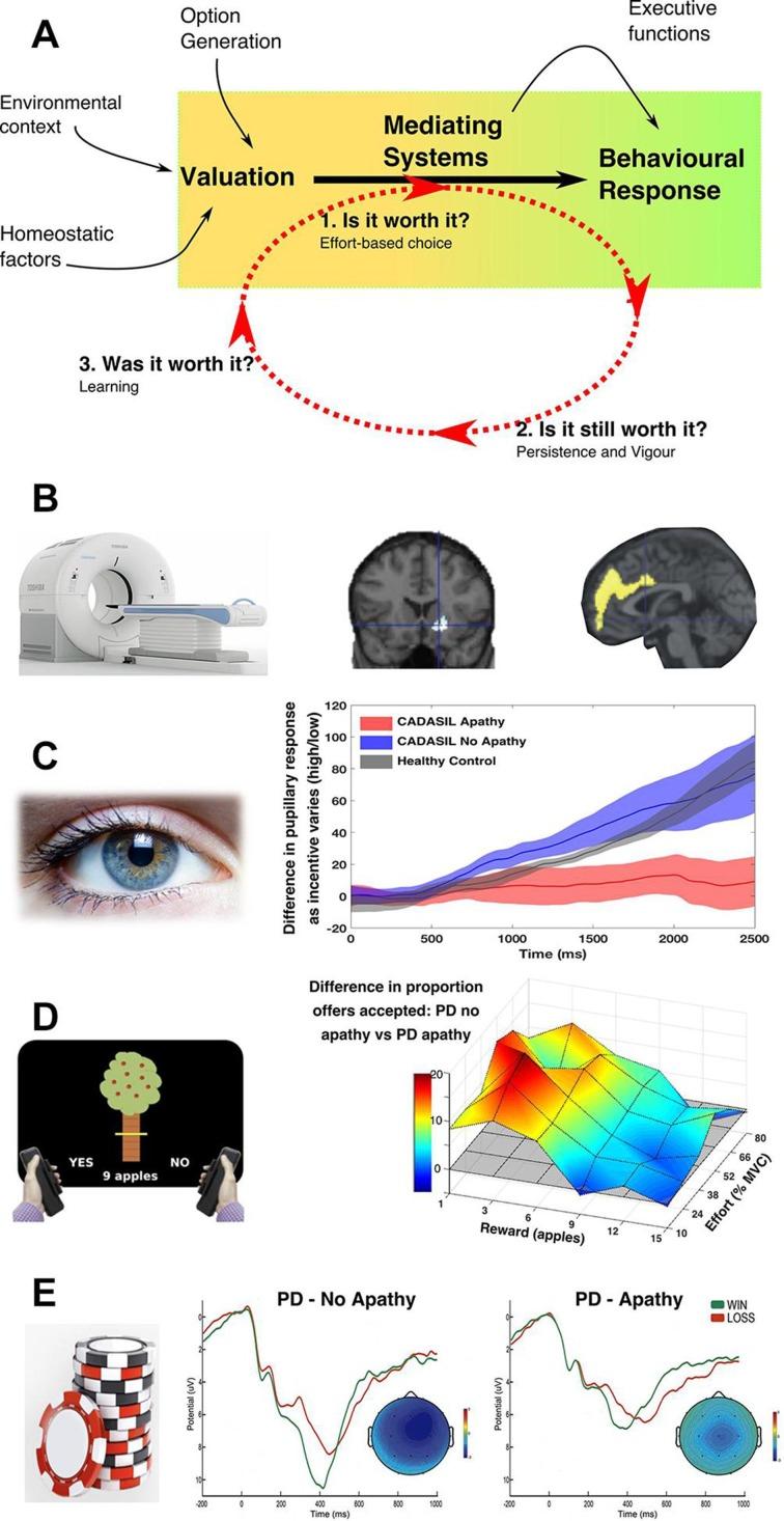 https://cdn.ncbi.nlm.nih.gov/pmc/blobs/1e92/6518466/4a10018a9a09/jnnp-2018-318265f03.jpg