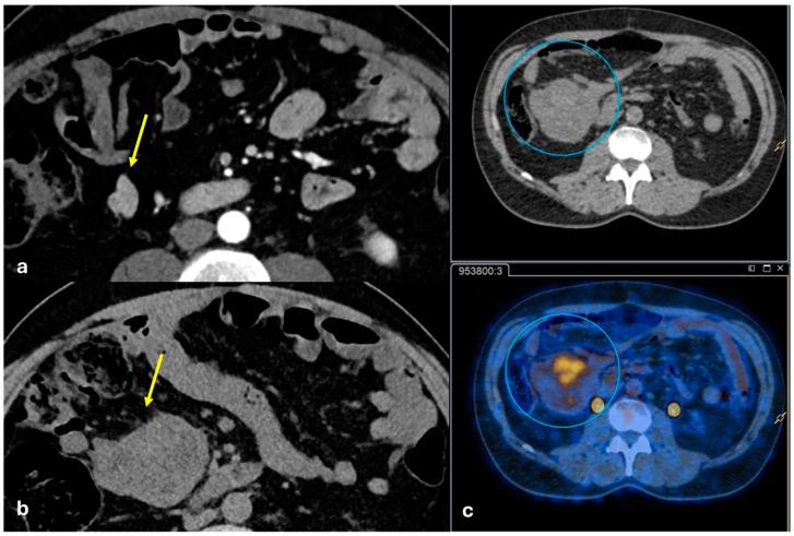 https://cdn.ncbi.nlm.nih.gov/pmc/blobs/1f87/12071784/9faa54a203b1/diagnostics-15-01163-g006.jpg
