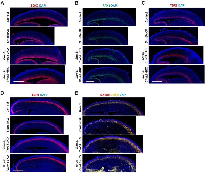 https://cdn.ncbi.nlm.nih.gov/pmc/blobs/1fea/7723410/a3b2f3bd8ce2/elife-61171-fig3-figsupp1.jpg