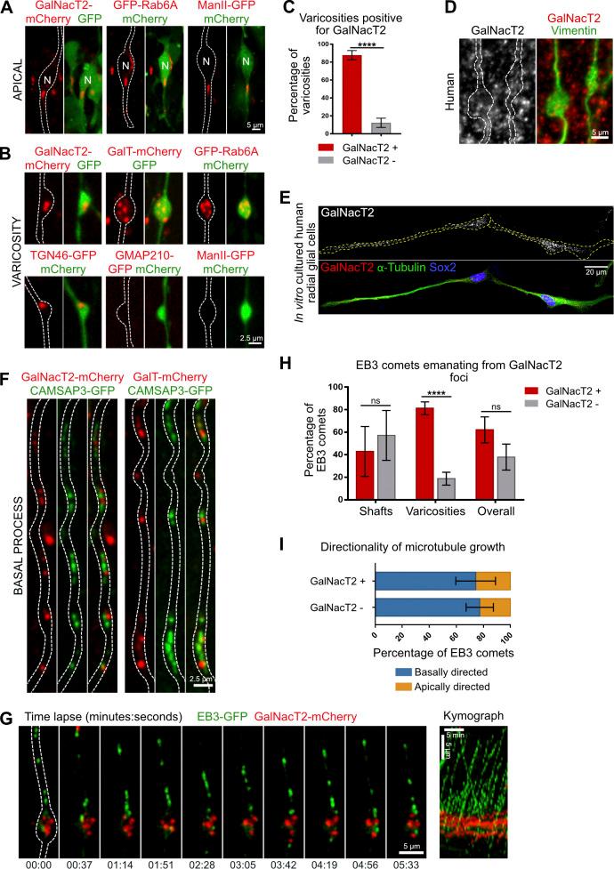 https://cdn.ncbi.nlm.nih.gov/pmc/blobs/1ff6/8144914/68a5188a4395/JCB_202003151_FigS3.jpg
