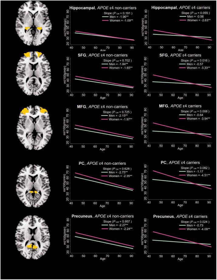 https://cdn.ncbi.nlm.nih.gov/pmc/blobs/21ef/8756470/c54beff85f70/10.1177_0271678X211021313-fig2.jpg