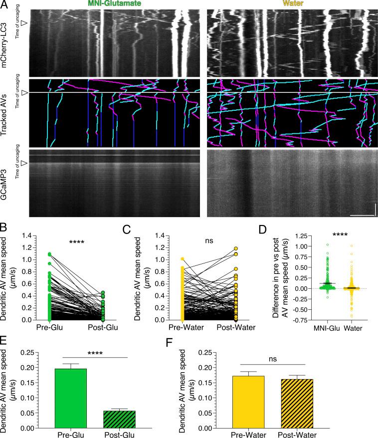 https://cdn.ncbi.nlm.nih.gov/pmc/blobs/246b/8020715/f029f2cc6cf7/JCB_202002084_Fig6.jpg