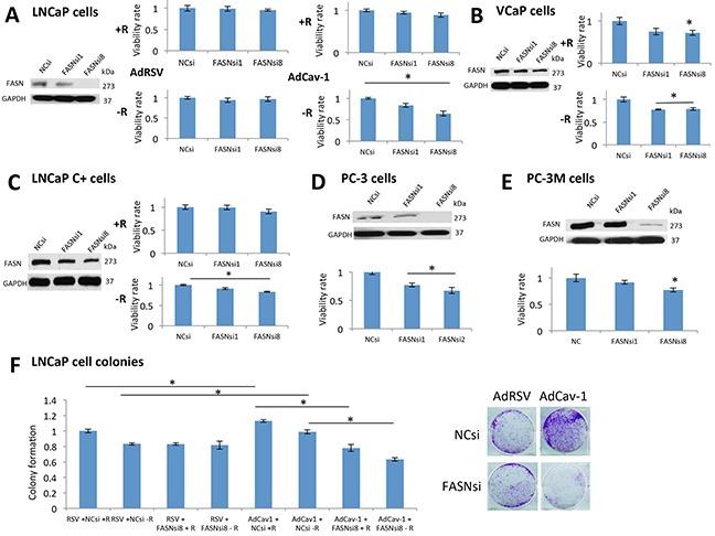 https://cdn.ncbi.nlm.nih.gov/pmc/blobs/257e/5216801/09909a1c1007/oncotarget-07-46321-g004.jpg