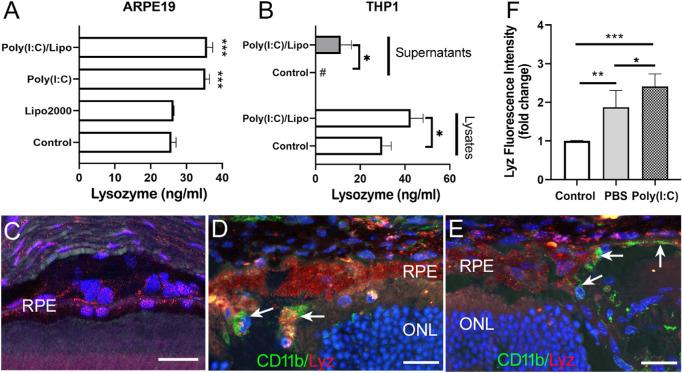 https://cdn.ncbi.nlm.nih.gov/pmc/blobs/2628/8237105/454c5ea813ed/iovs-62-7-21-f005.jpg