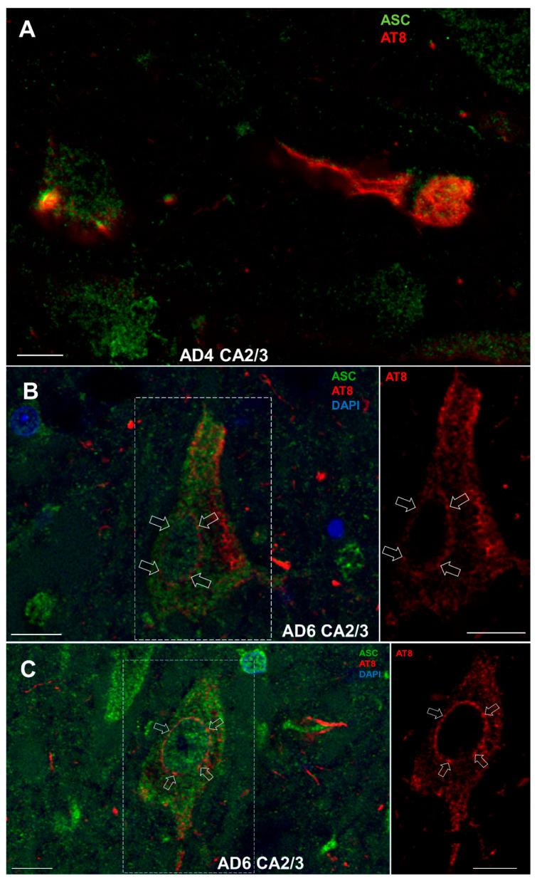 https://cdn.ncbi.nlm.nih.gov/pmc/blobs/281a/9324749/b7f15159083b/cells-11-02223-g012.jpg