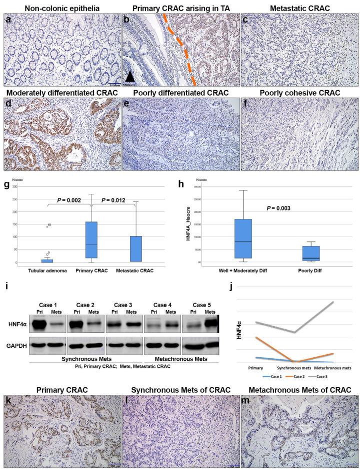 https://cdn.ncbi.nlm.nih.gov/pmc/blobs/288e/12025726/aa89bd9d4040/cells-14-00599-g003.jpg