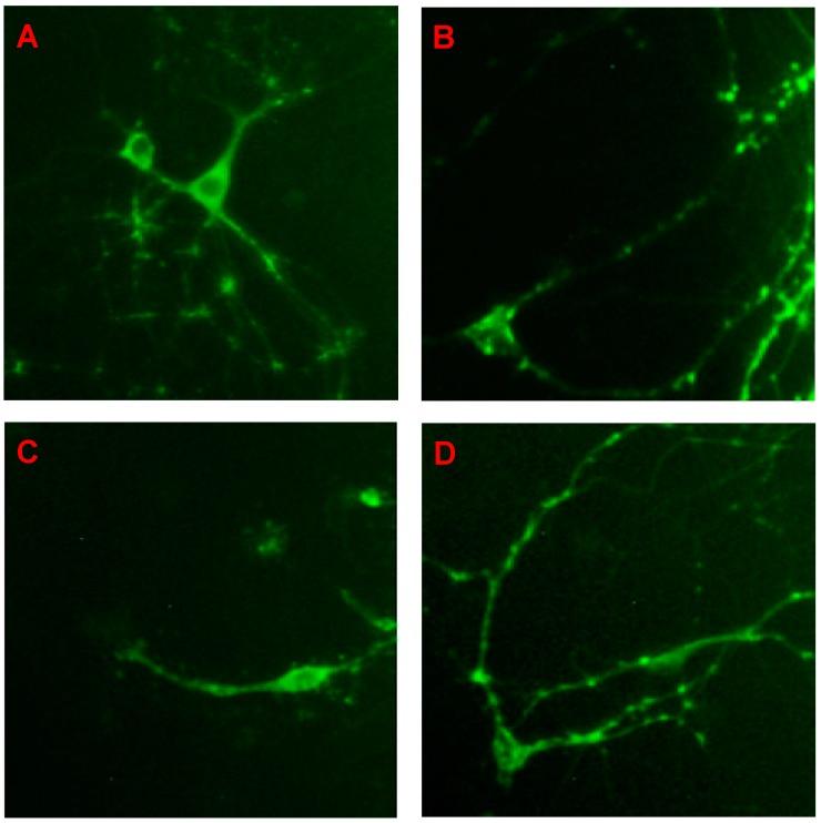 https://cdn.ncbi.nlm.nih.gov/pmc/blobs/2cfe/6274286/eb6efd948b68/molecules-21-00260-g003.jpg