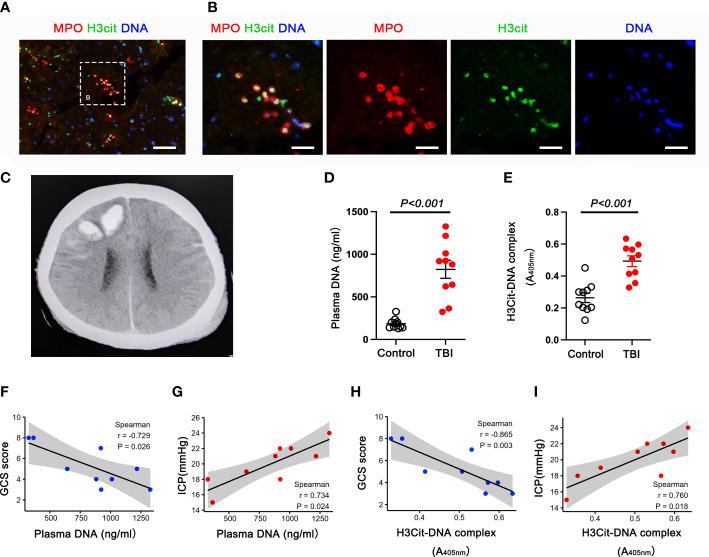 https://cdn.ncbi.nlm.nih.gov/pmc/blobs/2d5c/10152368/03cfab2faa61/fimmu-14-1125759-g001.jpg