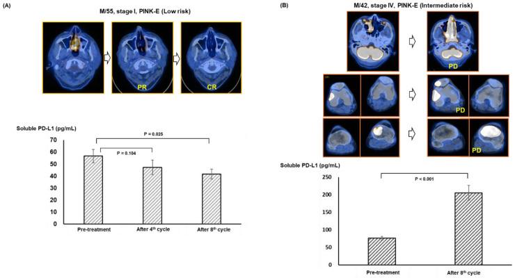 https://cdn.ncbi.nlm.nih.gov/pmc/blobs/2eeb/9688922/ea72689a4d60/cancers-14-05618-g004.jpg