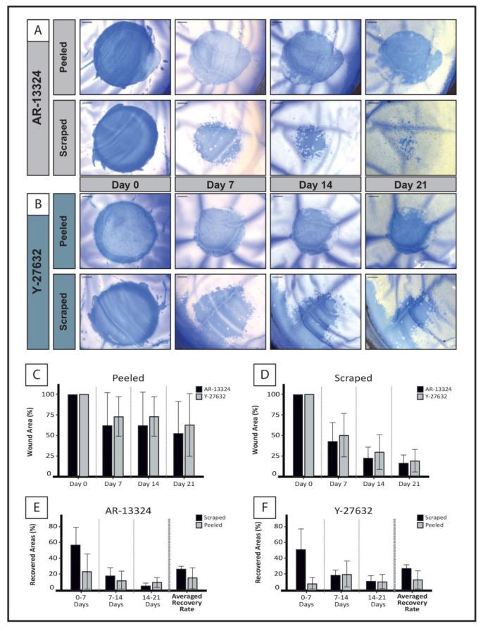 https://cdn.ncbi.nlm.nih.gov/pmc/blobs/2f14/10177577/8bfdf708c989/cells-12-01307-g003.jpg