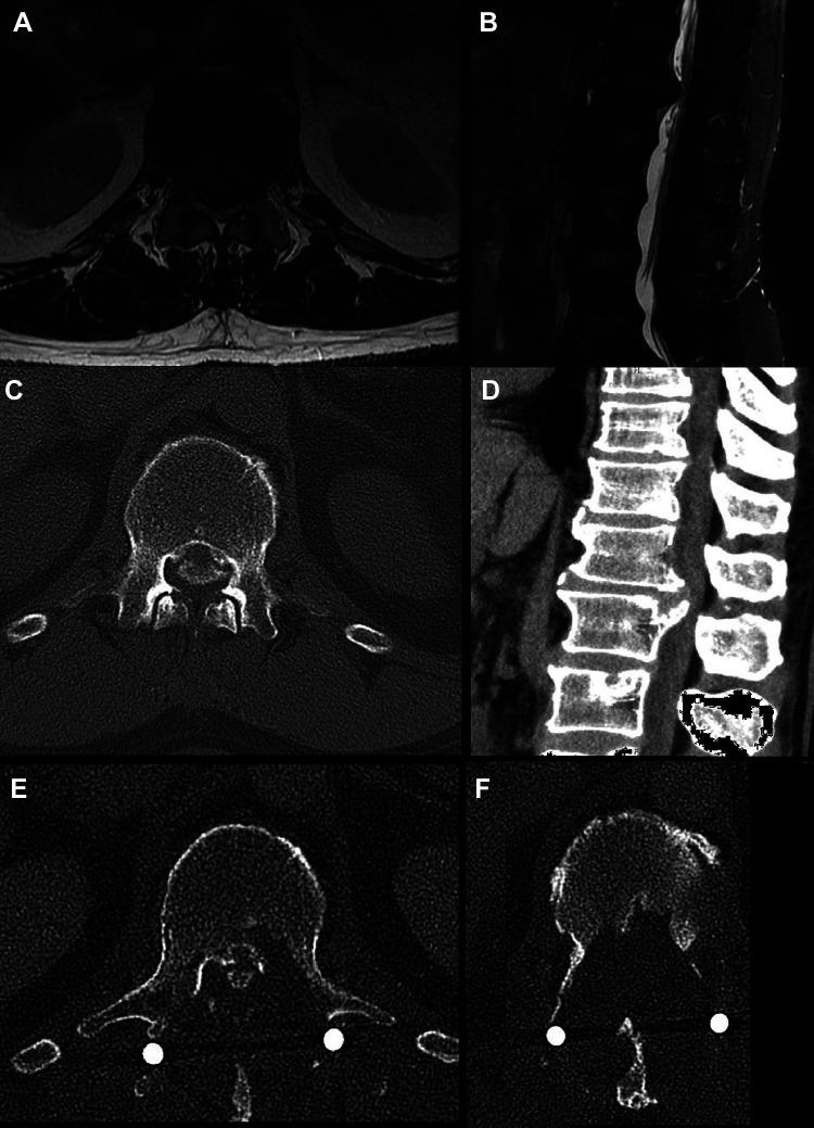 https://cdn.ncbi.nlm.nih.gov/pmc/blobs/312e/8258812/b2c7dc9ec786/10.1177_2192568220933275-fig1.jpg