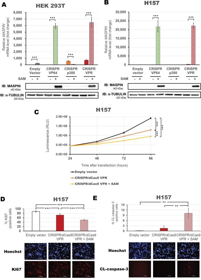 https://cdn.ncbi.nlm.nih.gov/pmc/blobs/336b/5312401/d025102d7834/oncotarget-07-60535-g006.jpg