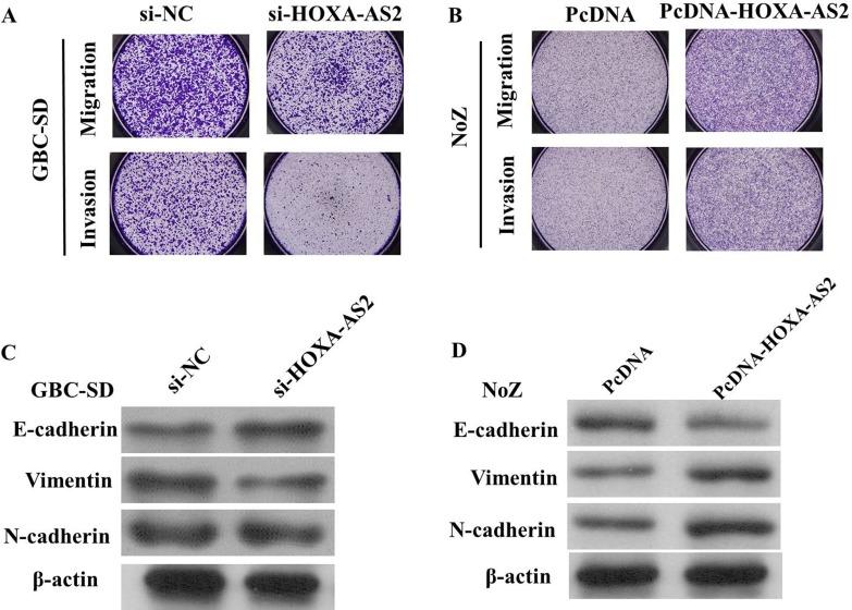 https://cdn.ncbi.nlm.nih.gov/pmc/blobs/3914/5464856/8ca2642dea30/oncotarget-08-33137-g005.jpg
