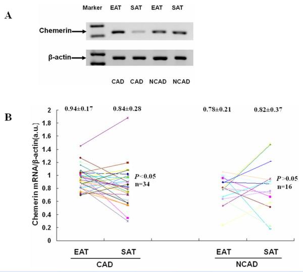https://cdn.ncbi.nlm.nih.gov/pmc/blobs/3949/3198902/1f2145ec5be8/1475-2840-10-87-3.jpg