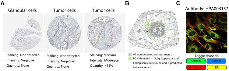 https://cdn.ncbi.nlm.nih.gov/pmc/blobs/3b48/8290488/5c6546630cfc/IJGM-14-3497-g0003.jpg