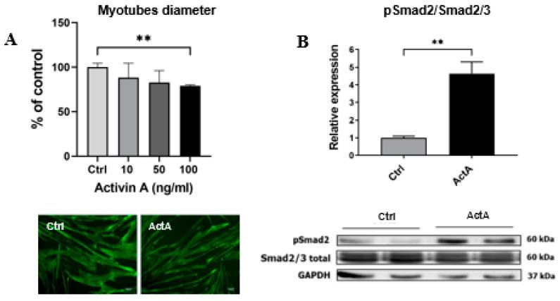 https://cdn.ncbi.nlm.nih.gov/pmc/blobs/3ebc/8997966/ba3ac4af917b/cells-11-01119-g001.jpg