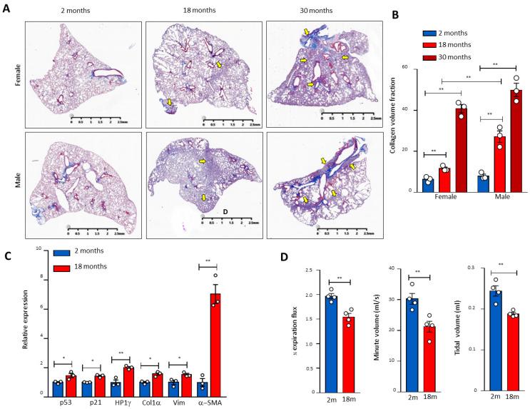 https://cdn.ncbi.nlm.nih.gov/pmc/blobs/3fb5/8616483/1bd0f265e64c/cells-10-02892-g001.jpg