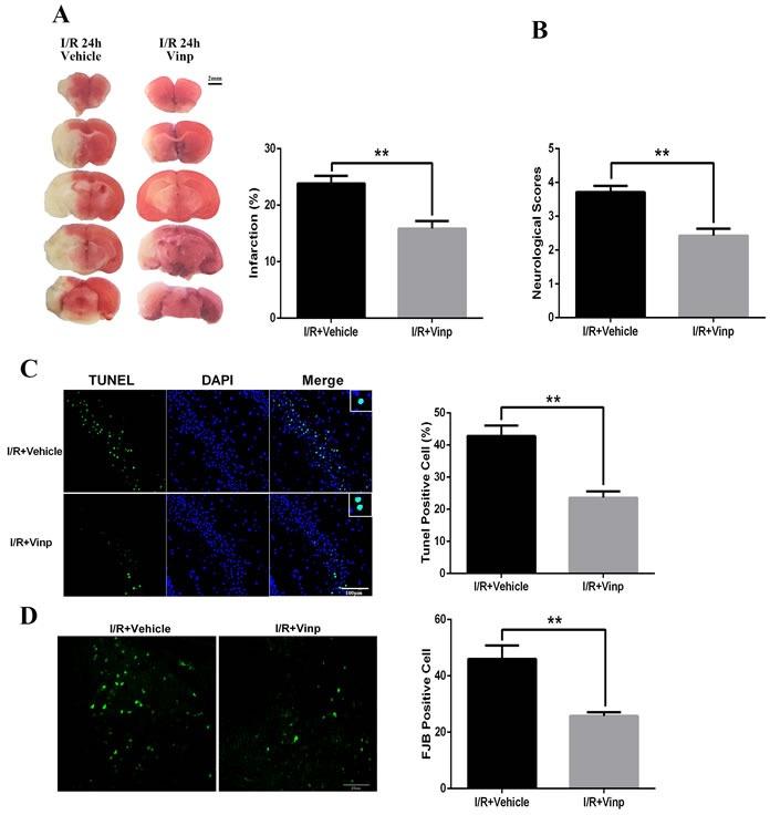 https://cdn.ncbi.nlm.nih.gov/pmc/blobs/4086/5655200/364f21ca1957/oncotarget-08-80315-g001.jpg