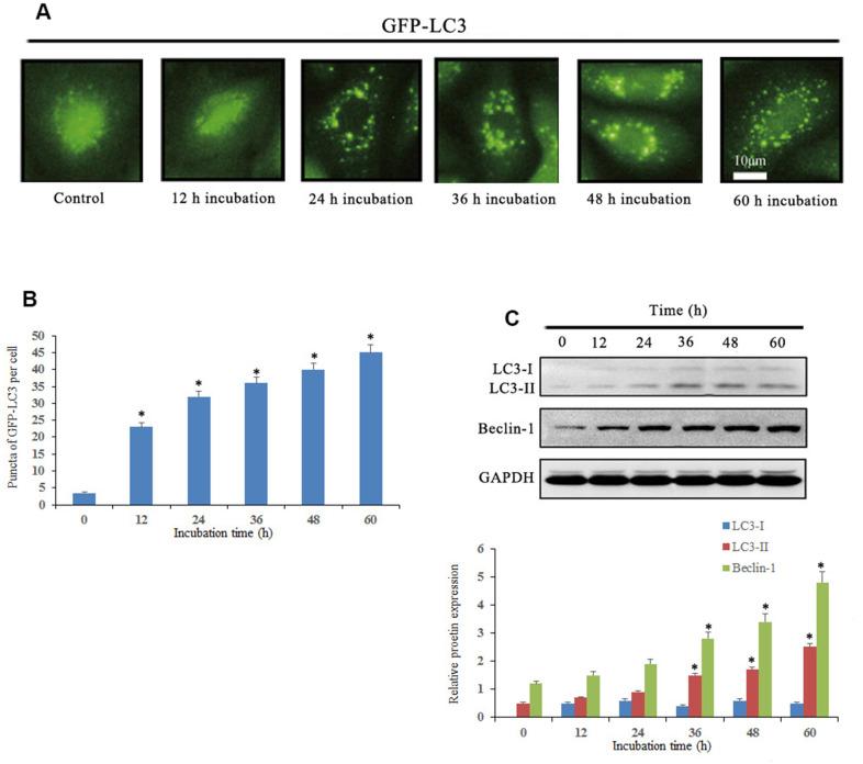 https://cdn.ncbi.nlm.nih.gov/pmc/blobs/4154/8457590/6bb3cd17a4d4/aging-13-203261-g005.jpg