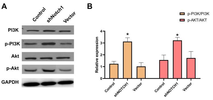 https://cdn.ncbi.nlm.nih.gov/pmc/blobs/4154/8457590/7ddc5ca77407/aging-13-203261-g007.jpg