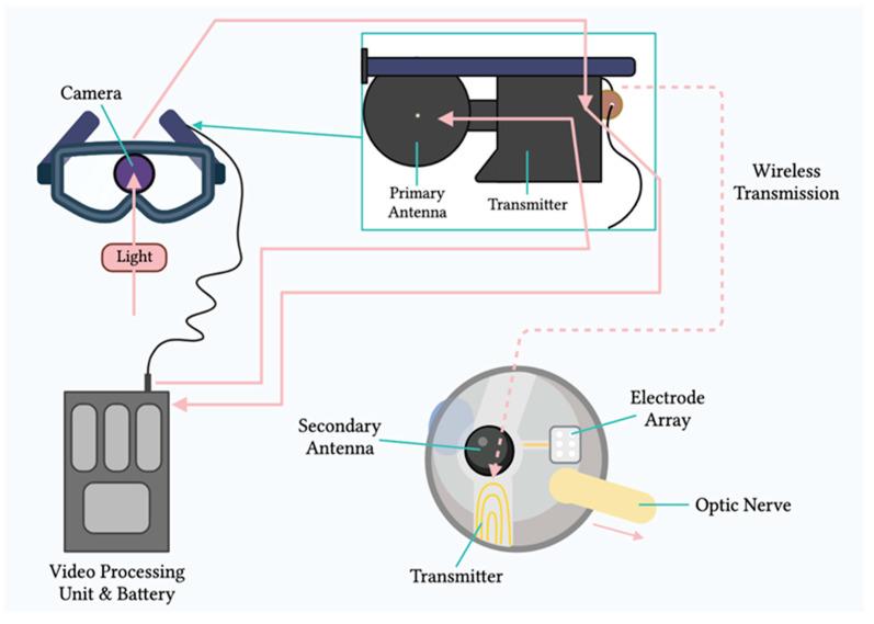 https://cdn.ncbi.nlm.nih.gov/pmc/blobs/41b9/10347280/031e28264d27/sensors-23-05782-g002.jpg