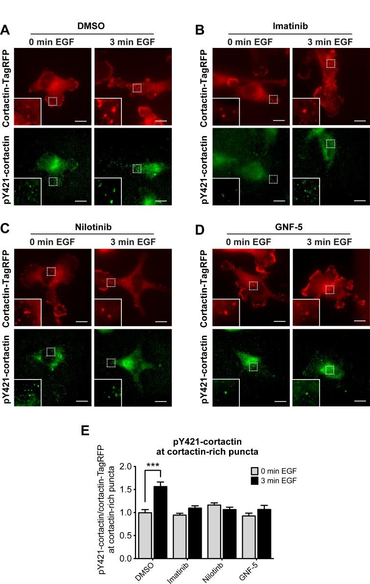 https://cdn.ncbi.nlm.nih.gov/pmc/blobs/43e0/5955141/055c9f7297ac/oncotarget-09-22158-g003.jpg