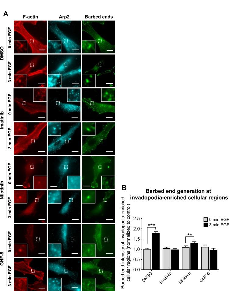https://cdn.ncbi.nlm.nih.gov/pmc/blobs/43e0/5955141/44d7a3fb2e8d/oncotarget-09-22158-g004.jpg