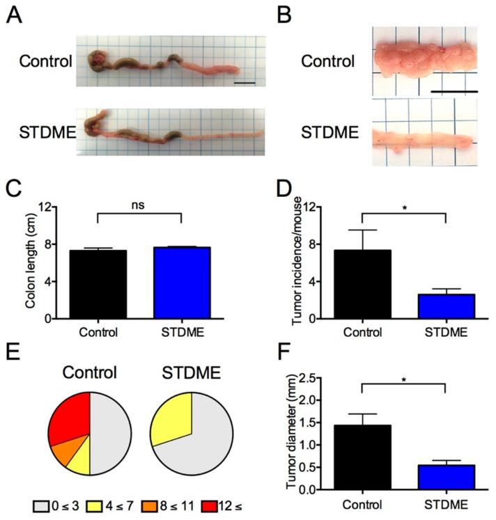 https://cdn.ncbi.nlm.nih.gov/pmc/blobs/4840/6212930/2239e39c86b9/nutrients-10-01380-g002.jpg