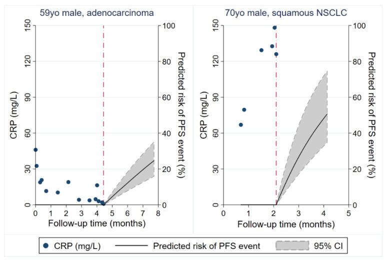 https://cdn.ncbi.nlm.nih.gov/pmc/blobs/491c/7464328/b1e153c44e60/cancers-12-02319-g005.jpg
