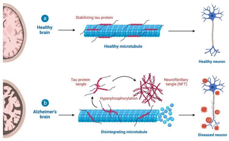 https://cdn.ncbi.nlm.nih.gov/pmc/blobs/4936/10216514/7b84bbbfa231/cells-12-01369-g004.jpg